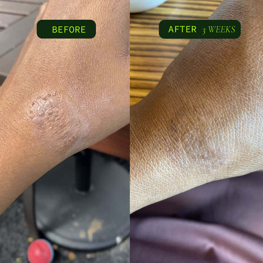 Unscented Omega Body Oil